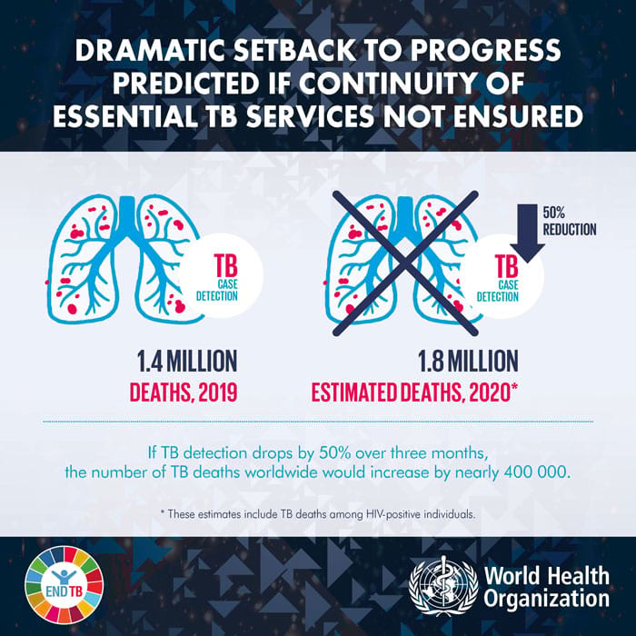 Source: WHO Global Tuberculosis Report 2020